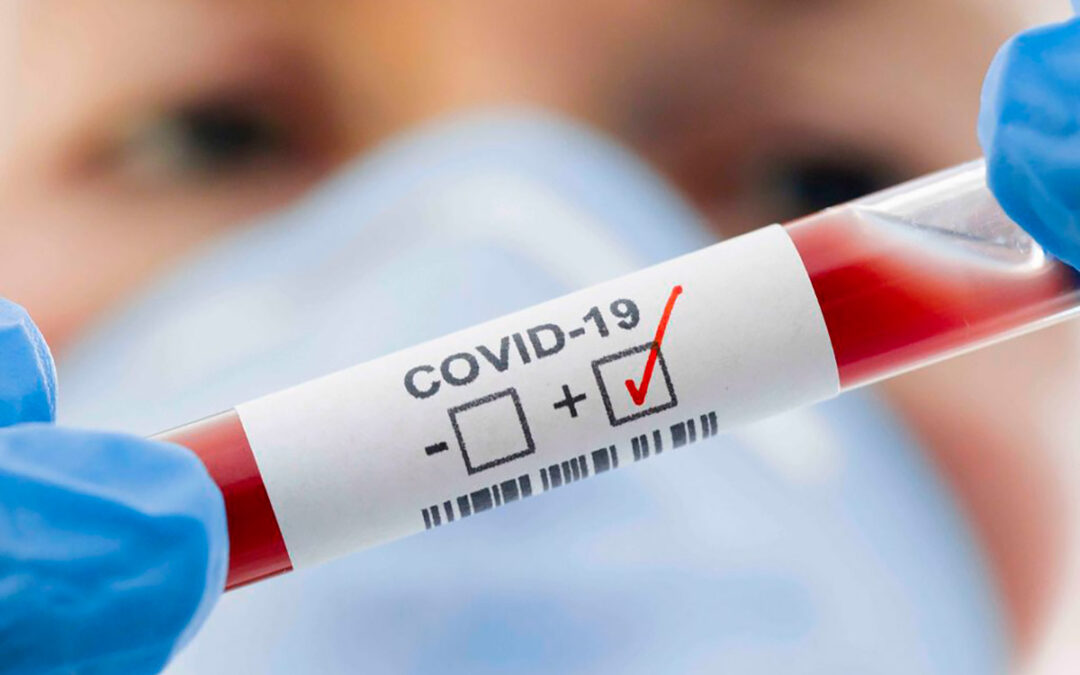 Laboratorio Politano – Loizzo. Tamponi e test sierologici