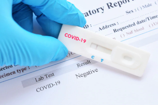 Bio Tech Estetic Srls. Distributore test sierologico per il covid-19